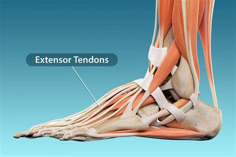 Extensor Tendonitis Foot