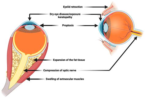 Eye Disease Management