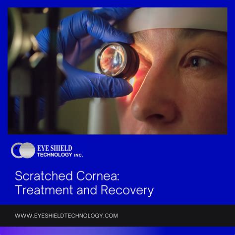 Eye Doctor For Scratched Eye