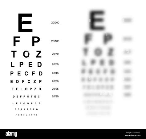Eye Exam For Blurry Vision