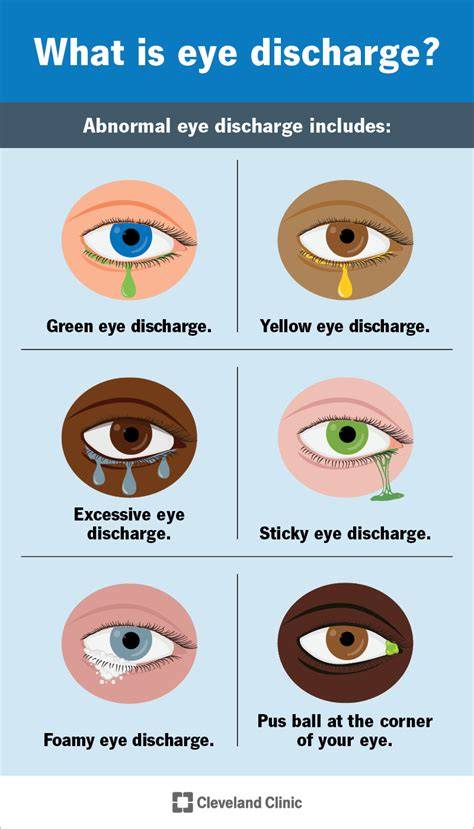 Eye Rheum In Infants