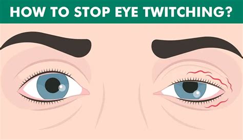 Eye Twitch Bottom Eyelid