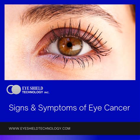 Eyes Cancer Treatment