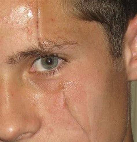 Eyes With Scars