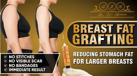 Fat Transfer To Breasts
