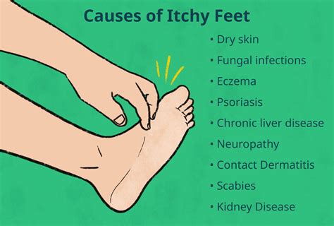 Feet That Itch