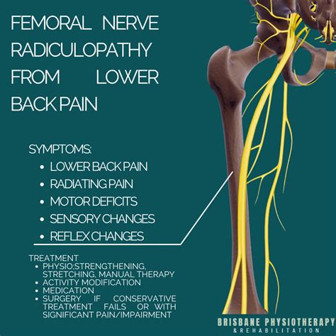 Femoral Nerve Pain