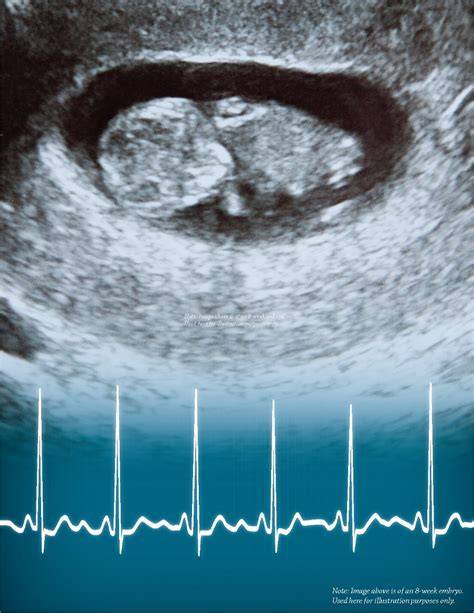 Fetal Heartbeat