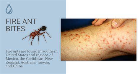 Fire Ants Bite