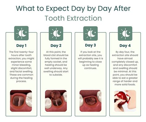 First Night After Tooth Extraction
