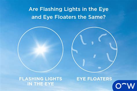 Flashes In Vision