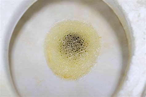 Foamy Urine In Men