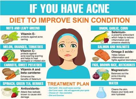 Foods That Cause Acne