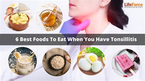 Foods To Eat After Tonsillectomy