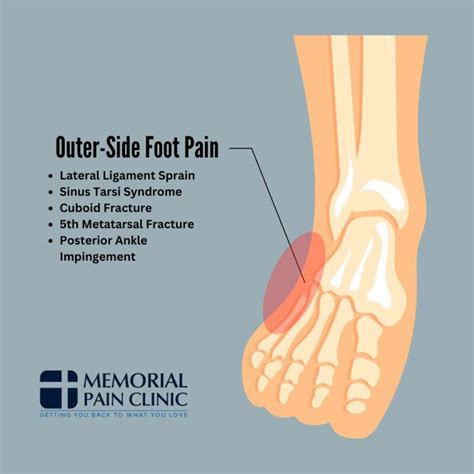 Foot Hurting On The Side