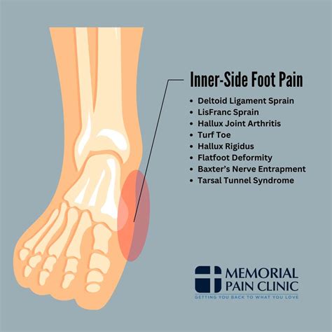 Foot Pain Side Of