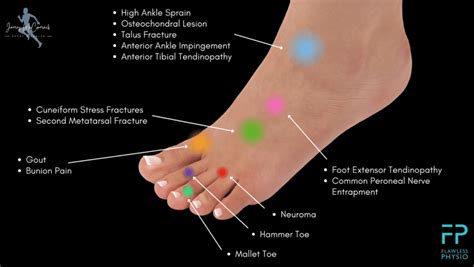 Foot Pain Top Of Foot