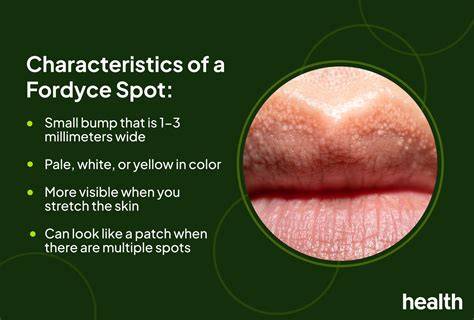 Fordyce Spots On Lips