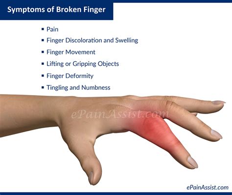 Fractured Finger Symptoms