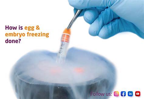 Freezing A Embryo