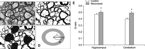 G Ratio In Axons