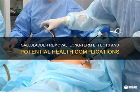 Gallbladder Removal Effects