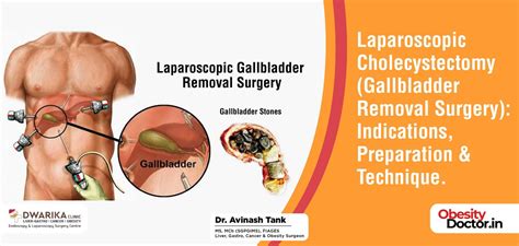 Gallbladder Removal Recovery