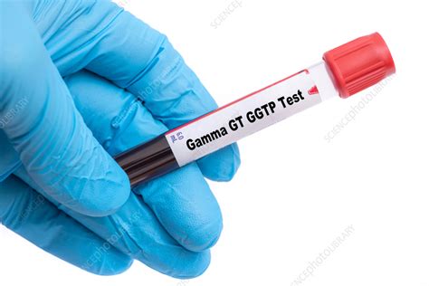 Gamma Gt Blood Test