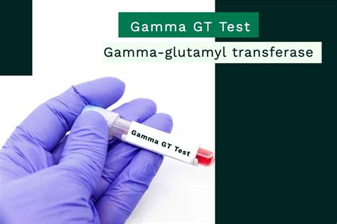 Gamma Gt Test