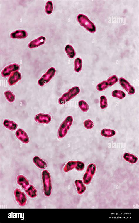 Genus Of Yersinia Pestis