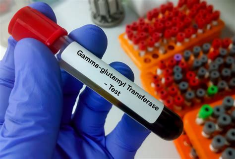 Glutamyl Transferase Test