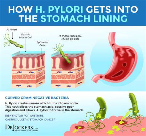H Pylori Does It Cause Vomiting