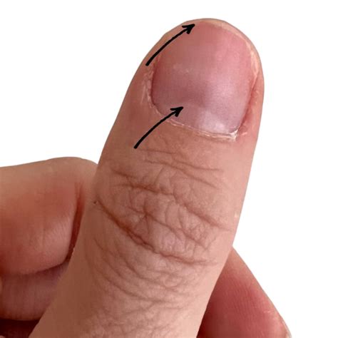 Half Moon On Thumb Nail