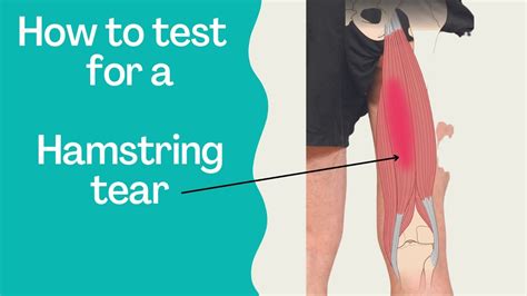Hamstring Pull Vs Tear