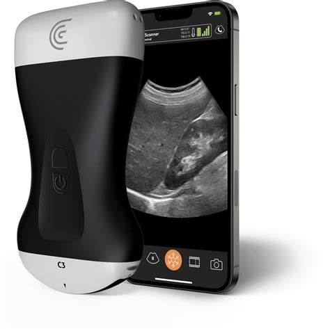 Handheld Ultrasound Machine