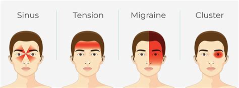 Headache Behind The Eyes