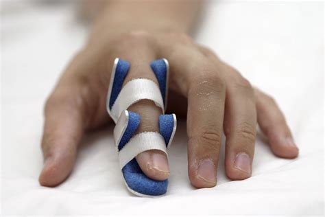 Heal Broken Finger