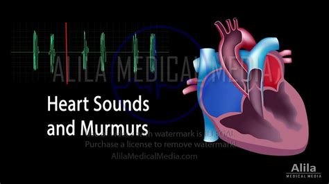 Heart Murmur In Spanish