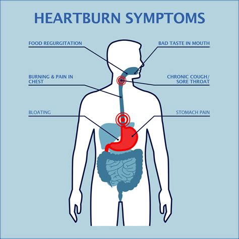 Heartburn And Back Pain