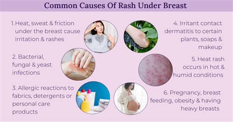 Heat Rash Under Boobs