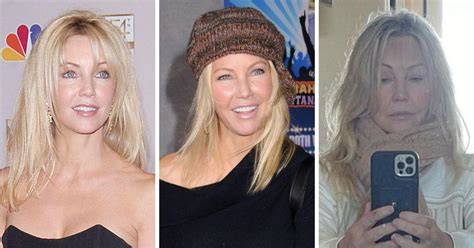 Heather Locklear Face Surgery