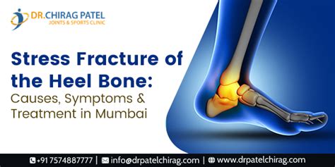 Heel Stress Fracture
