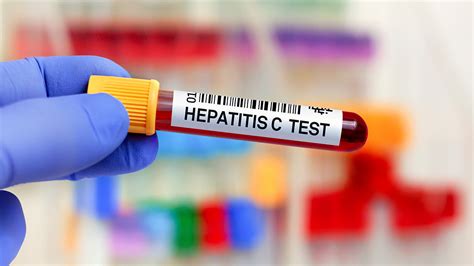 Hep C Test