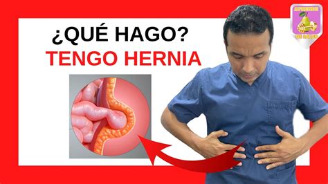 Hernia En El Estomago