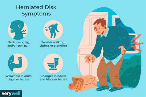 Herniated Disc Surgery Recovery Time