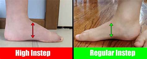 High Instep And High Arch