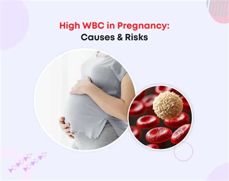 Higher Wbc Count In Pregnancy