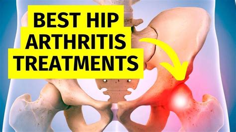 Hip Treatment For Pain