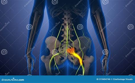 Hips Nerve Pain