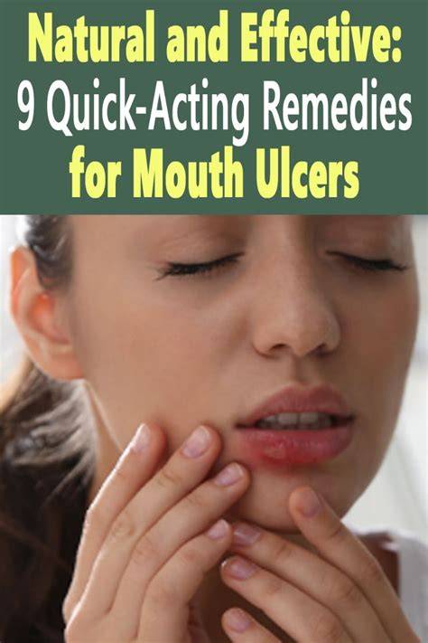 Homeopathic Cure For Mouth Ulcers